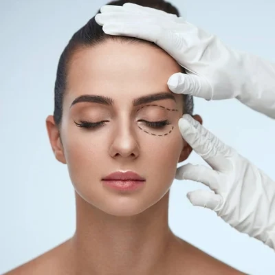 Blepharoplasty in Iran