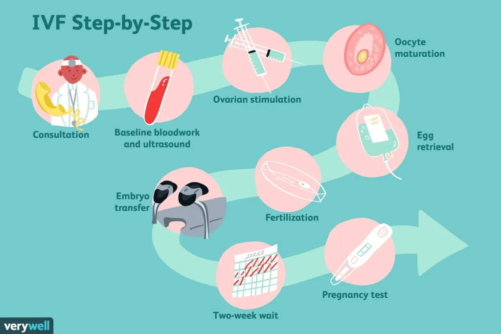 IVF step by step