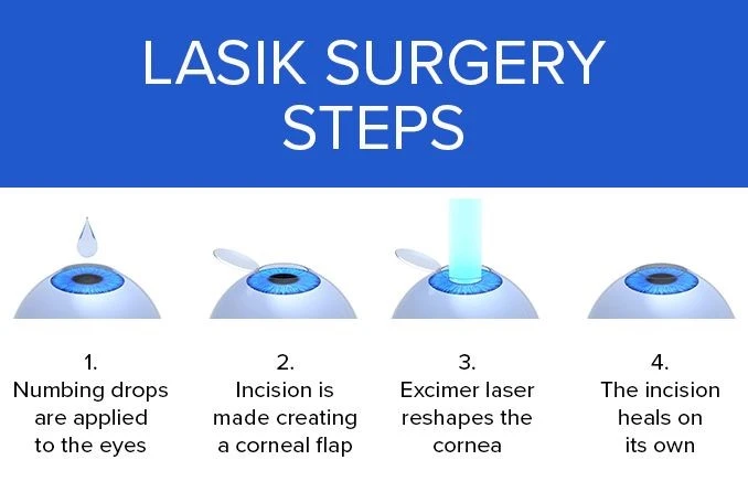 Lasik and Lasek Eye Surgery in Iran