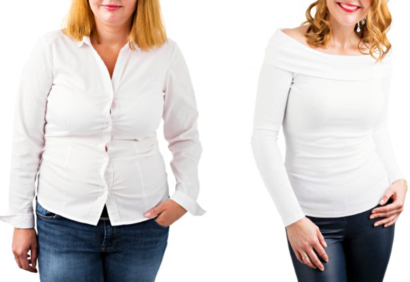 Types of Weight Loss Surgery