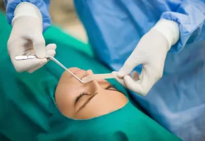 septoplasty in iran