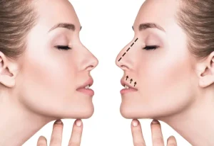 septoplasty vs rhinoplasty