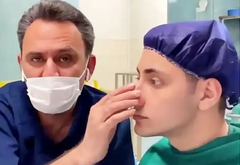 top 10 rhinoplasty surgeons in iran