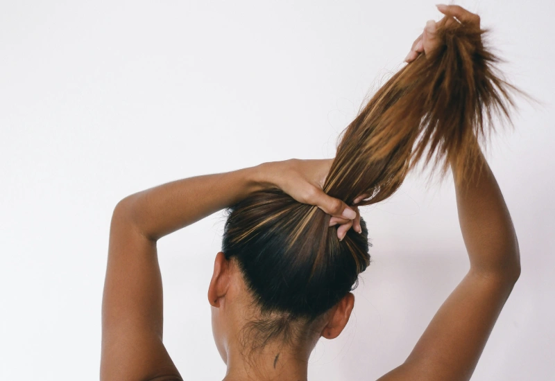 Traction alopecia regrowth