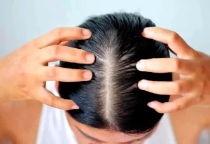 itchy scalp