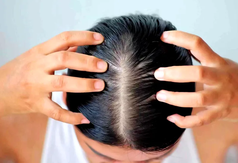 Itchy Scalp: Causes, Treatment, Products