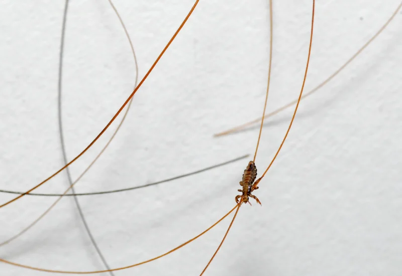 Head Lice Pictures