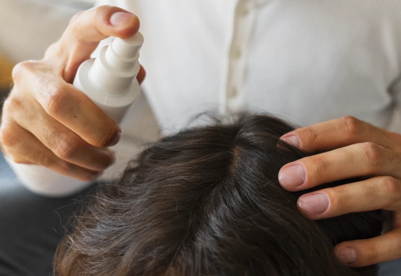 Head Lice Prevention