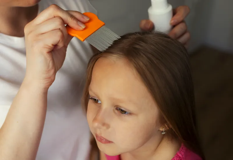 How to Remove Head Lice