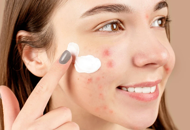 Skin Blemishes Treatment