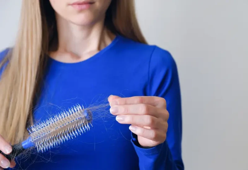 hair loss after weight loss