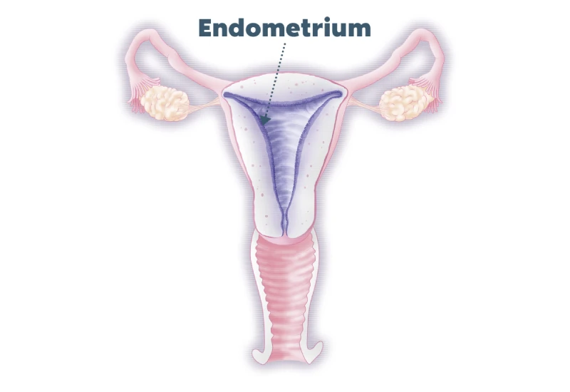 Diagnosis of Endometritis