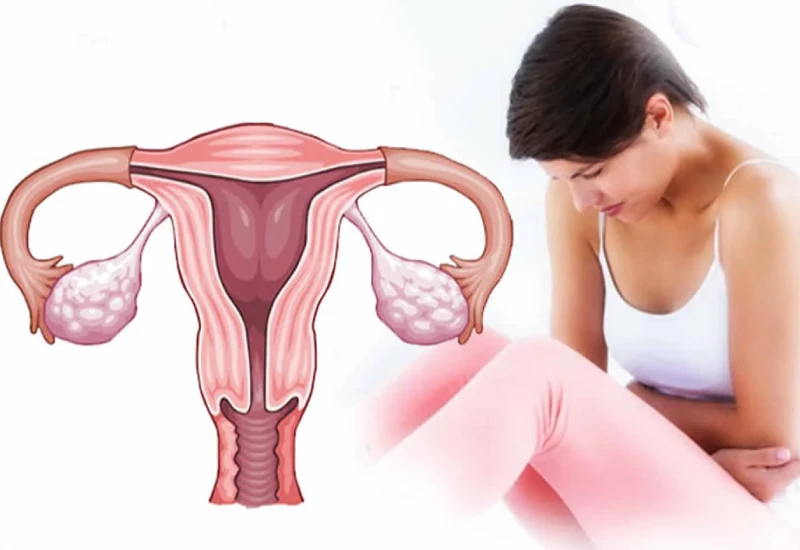 Uterine Prolapse Causes