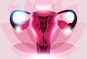 polycystic ovary syndrome