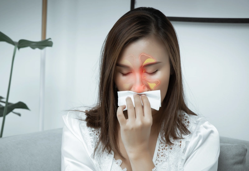 sinusitis symptoms