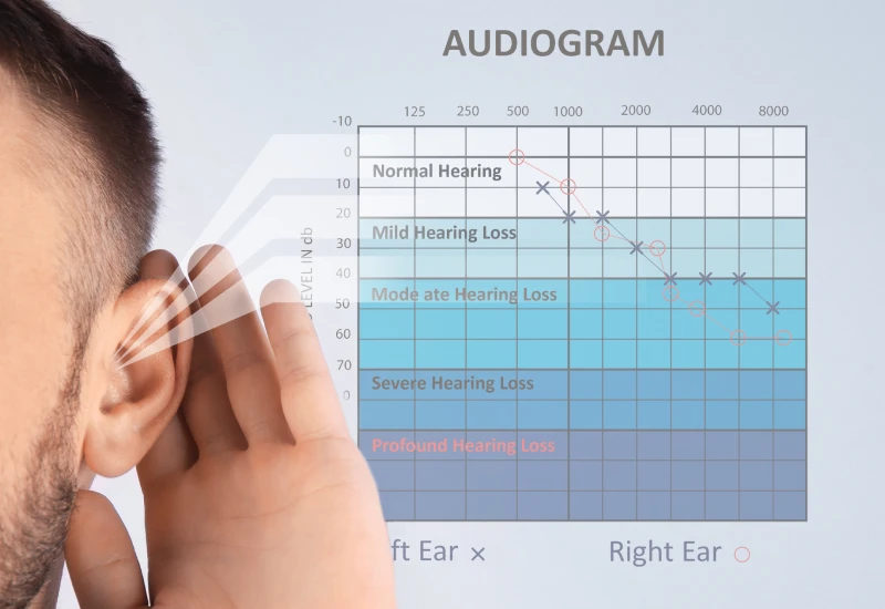 Audiogram Test Symbols