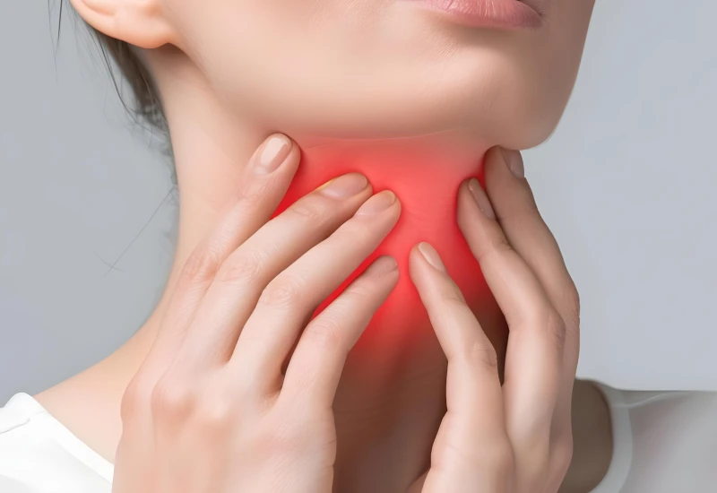 Laryngitis